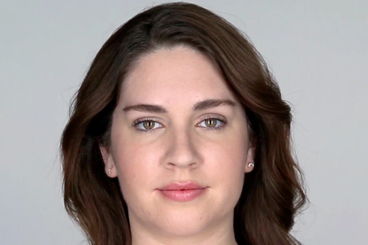 woman after getting BOTOX in Clearwater, FL