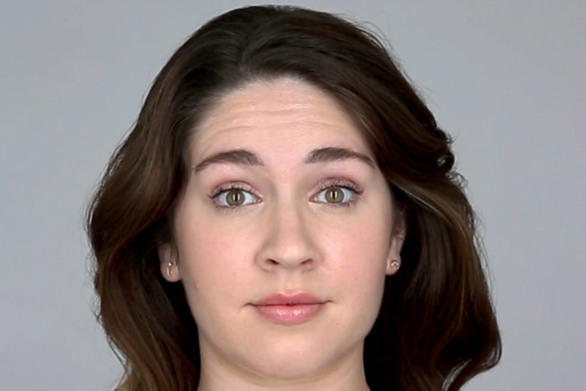 woman before getting BOTOX in Clearwater, FL
